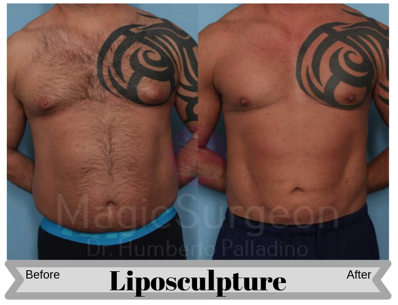 Male Plastic Surgery: the Daddy Makeover